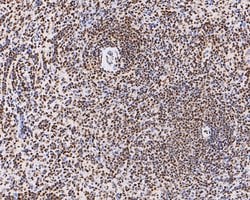 Invitrogen H3K18ac Monoclonal Antibody (A7B5) 100 &mu;L; Unconjugated:Antibodies,
