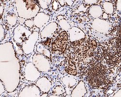 Invitrogen H3K18ac Monoclonal Antibody (A7B5) 100 &mu;L; Unconjugated:Antibodies,