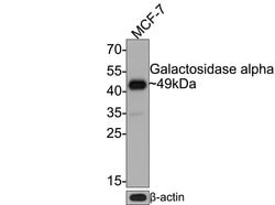 Invitrogen alpha Galactosidase Monoclonal Antibody (A7C4) 100 &mu;L; Unconjugated:Antibodies,