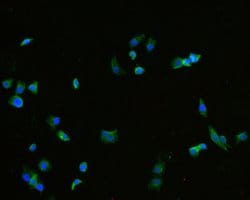 Invitrogen TROP2 Monoclonal Antibody (A5E4) 100 &mu;L; Unconjugated:Antibodies,