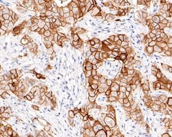 Invitrogen TROP2 Monoclonal Antibody (A5E4) 100 &mu;L; Unconjugated:Antibodies,