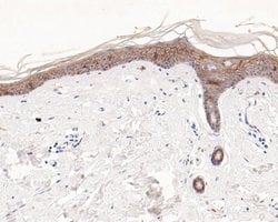 Invitrogen TROP2 Monoclonal Antibody (A5E5) 100 &mu;L; Unconjugated:Antibodies,