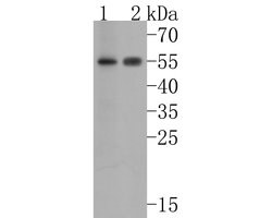 Invitrogen IL11RA Monoclonal Antibody (A6G8) 100 &mu;L; Unconjugated:Antibodies,