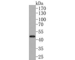 Invitrogen IL11RA Monoclonal Antibody (A6G8) 100 &mu;L; Unconjugated:Antibodies,