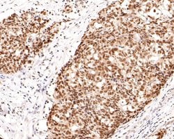 Invitrogen NCoR1 Monoclonal Antibody (A6H12) 100 &mu;L | Buy Online | Invitrogen&trade; | Fisher Scientific