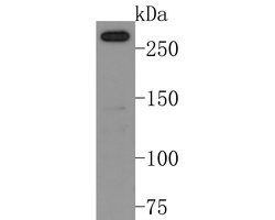 Invitrogen NCoR1 Monoclonal Antibody (A6H12) 100 &mu;L | Buy Online | Invitrogen&trade; | Fisher Scientific