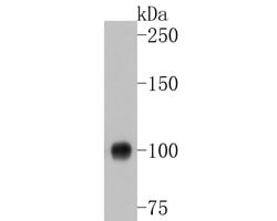 Invitrogen PSMA Monoclonal Antibody (A5F12) 100 &mu;L; Unconjugated:Antibodies,