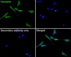 Invitrogen TSC1 Monoclonal Antibody (A6F1) 100 &mu;L; Unconjugated:Antibodies,