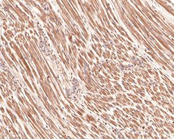 Invitrogen TSC1 Monoclonal Antibody (A6F1) 100 &mu;L; Unconjugated:Antibodies,