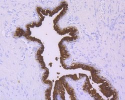 Invitrogen PSA Recombinant Rabbit Monoclonal Antibody (JE19-84) 100 &mu;L;
