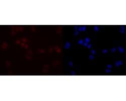Invitrogen SIRT1 Recombinant Rabbit Monoclonal Antibody (JE11-04) 100 &mu;L;