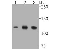 Invitrogen SIRT1 Recombinant Rabbit Monoclonal Antibody (JE11-04) 100 &mu;L;