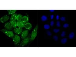 Invitrogen alpha Synuclein Recombinant Rabbit Monoclonal Antibody (JB42-33) 100 &mu;L | Buy Online | Invitrogen&trade; | Fisher Scientific