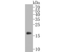 Invitrogen alpha Synuclein Recombinant Rabbit Monoclonal Antibody (JB42-33) 100 &mu;L | Buy Online | Invitrogen&trade; | Fisher Scientific