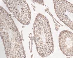 Invitrogen Vinculin Recombinant Rabbit Monoclonal Antibody (JM42-43) 100