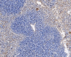 Invitrogen Vinculin Recombinant Rabbit Monoclonal Antibody (JM42-43) 100