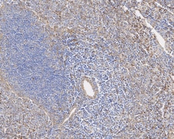 Invitrogen Vinculin Recombinant Rabbit Monoclonal Antibody (JM42-43) 100