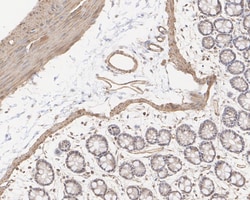 Invitrogen Vinculin Recombinant Rabbit Monoclonal Antibody (JM42-43) 100