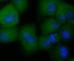 Invitrogen CCL5 (RANTES) Recombinant Rabbit Monoclonal Antibody (JM03-45) 100 &mu;L | Buy Online | Invitrogen&trade; | Fisher Scientific