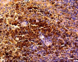 Invitrogen CCL5 (RANTES) Recombinant Rabbit Monoclonal Antibody (JM03-45) 100 &mu;L | Buy Online | Invitrogen&trade; | Fisher Scientific