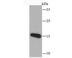 Invitrogen CCL5 (RANTES) Recombinant Rabbit Monoclonal Antibody (JM03-45) 100 &mu;L | Buy Online | Invitrogen&trade; | Fisher Scientific