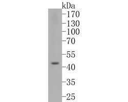 Invitrogen FOXP3 Recombinant Rabbit Monoclonal Antibody (JF0898) 100 &mu;L;