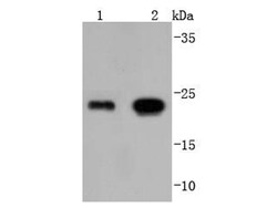 Invitrogen GPX1 Recombinant Rabbit Monoclonal Antibody (JJ092-07) 100 &mu;L;