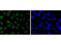 Invitrogen JunD Recombinant Rabbit Monoclonal Antibody (SD0830) 100 μL;