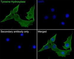 Invitrogen Tyrosine Hydroxylase Recombinant Rabbit Monoclonal Antibody