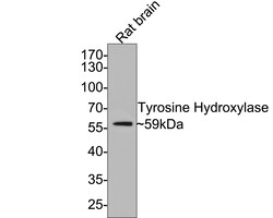 Invitrogen Tyrosine Hydroxylase Recombinant Rabbit Monoclonal Antibody