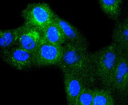 beta-2 Microglobulin Recombinant Rabbit Monoclonal Antibody (SU35-05):Antibodies,