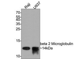 beta-2 Microglobulin Recombinant Rabbit Monoclonal Antibody (SU35-05):Antibodies,