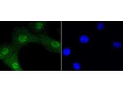 Invitrogen Phospho-AKT1 (Ser473) Recombinant Rabbit Monoclonal Antibody