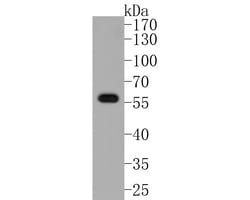 Invitrogen Phospho-AKT1 (Ser473) Recombinant Rabbit Monoclonal Antibody