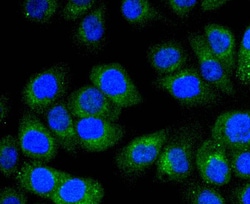 Invitrogen STAT6 Recombinant Rabbit Monoclonal Antibody (SY02-72) 100 &mu;L;