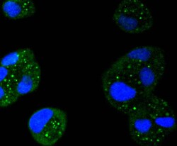 Invitrogen STAT6 Recombinant Rabbit Monoclonal Antibody (SY02-72) 100 &mu;L;