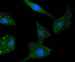 Invitrogen STAT6 Recombinant Rabbit Monoclonal Antibody (SY02-72) 100 &mu;L;