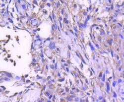 Invitrogen STAT6 Recombinant Rabbit Monoclonal Antibody (SY02-72) 100 &mu;L;