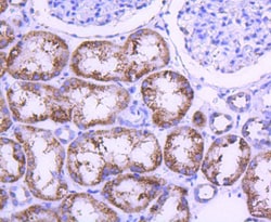 Invitrogen STAT6 Recombinant Rabbit Monoclonal Antibody (SY02-72) 100 &mu;L;