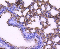 Invitrogen STAT6 Recombinant Rabbit Monoclonal Antibody (SY02-72) 100 &mu;L;