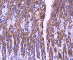 Invitrogen STAT6 Recombinant Rabbit Monoclonal Antibody (SY02-72) 100 &mu;L;