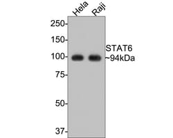 Invitrogen STAT6 Recombinant Rabbit Monoclonal Antibody (SY02-72) 100 &mu;L;