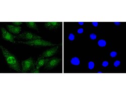 Invitrogen EGFR Recombinant Rabbit Monoclonal Antibody (SP00-86) 100 &mu;L;