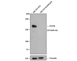 Invitrogen EGFR Recombinant Rabbit Monoclonal Antibody (SP00-86) 100 &mu;L;