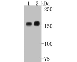Invitrogen EGFR Recombinant Rabbit Monoclonal Antibody (SP00-86) 100 &mu;L;