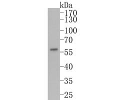 Invitrogen FOXA1 Monoclonal Antibody (A2E8) 100 &mu;L | Buy Online | Invitrogen&trade; | Fisher Scientific