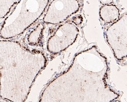 Invitrogen PAX8 Monoclonal Antibody (6G1) 100 &mu;L; Unconjugated:Antibodies,