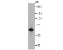 Invitrogen Cytokeratin 5/6 Monoclonal Antibody (A2B2) 100 &mu;L; Unconjugated:Antibodies,