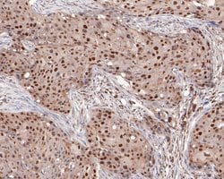 Invitrogen MSH2 Monoclonal Antibody (10G2) 100 &mu;L | Buy Online | Invitrogen&trade; | Fisher Scientific