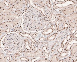 Invitrogen MSH2 Monoclonal Antibody (10G2) 100 &mu;L | Buy Online | Invitrogen&trade; | Fisher Scientific